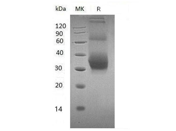 Mouse NKG2DL/ULBP Recombinant Protein (RPES2424)