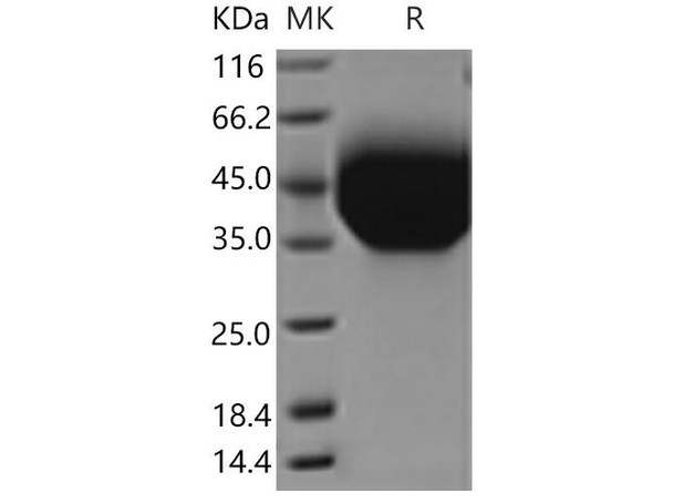 Mouse TIM-3/HAVCR2 Recombinant Protein (aa 191, His Tag) (RPES2436)