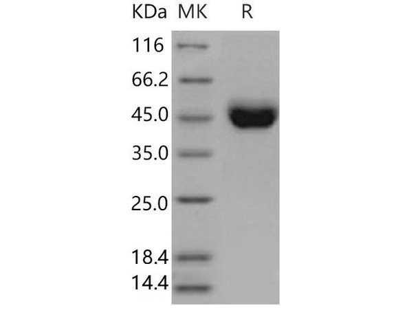 Mouse CD5 Recombinant Protein (aa 1-371, His Tag) (RPES2437)