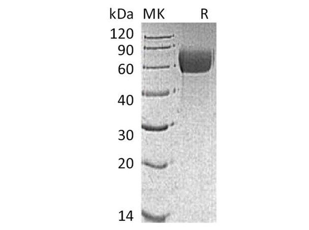 Mouse IL13RA1 Recombinant Protein (RPES2452)