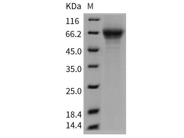 Mouse THSD1/TMTSP Recombinant Protein (His Tag) (RPES2458)