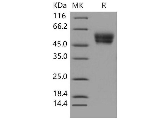 Mouse CADM4/IGSF4C/TSLL2 Recombinant Protein (His Tag) (RPES2466)