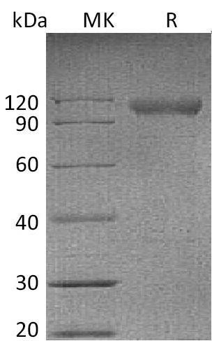 Mouse NgR/RTN4R Recombinant Protein (RPES2467)