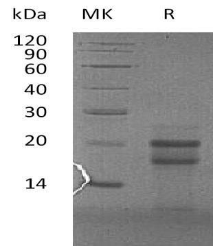 Human PFDN4 Recombinant Protein (RPES2484)