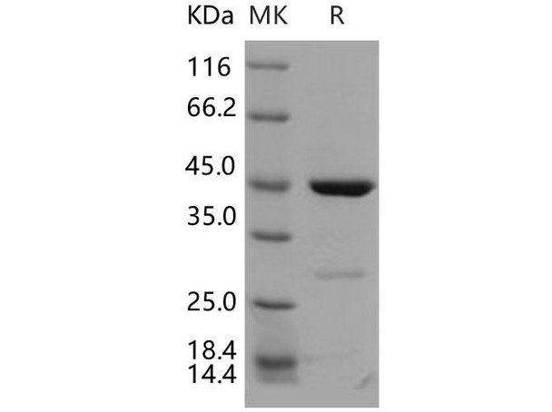 Human CDKN2D/p19ink4d Recombinant Protein (GST Tag) (Active) (RPES2494)