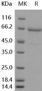 Human TLR2/CD282 Recombinant Protein (aa 1-587, His Tag) (RPES2496)