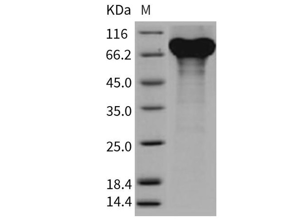 Mouse Granulin/GRN Recombinant Protein (His Tag) (RPES2498)