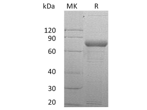 Human SIRP gamma/CD172g Recombinant Protein (RPES2547)