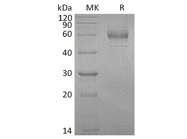 Human GFRA1/GDNFRA Recombinant Protein (RPES2548)