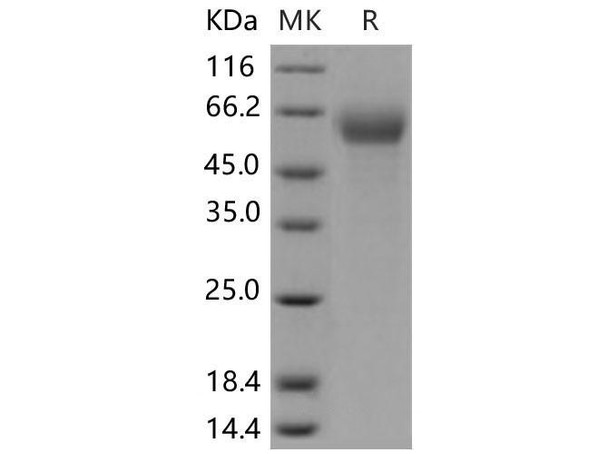 Mouse IFNAR1/IFNAR Recombinant Protein (His Tag) (Active) (RPES2564)