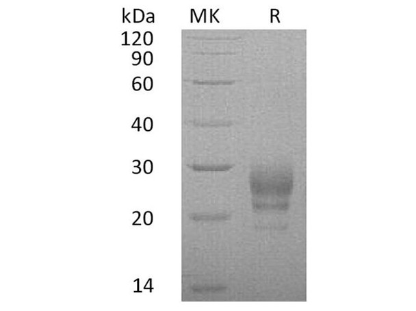 Human Interleukin-7/IL-7 Recombinant Protein (RPES2582)