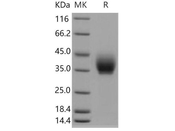 Mouse ICOS/AILIM Recombinant Protein (RPES2585)