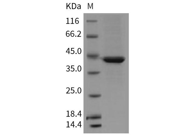 Mouse Serpinb6b Recombinant Protein (His Tag) (RPES2619)