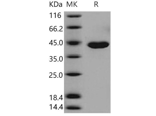 Mouse Carboxypeptidase A1 Recombinant Protein (RPES2647)