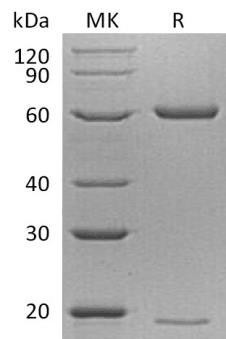 Mouse PCSK9/NARC1 Recombinant Protein (RPES2648)