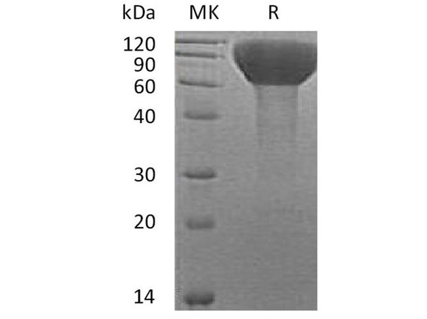Human FLRT3 Recombinant Protein (RPES2653)