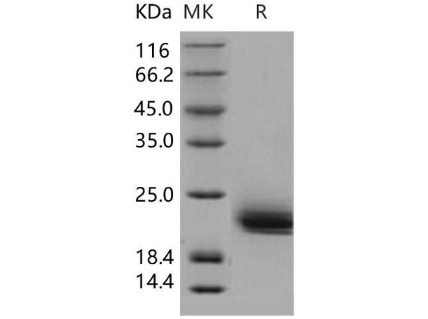 Human LAIR2/CD306 Recombinant Protein (His Tag) (Active) (RPES2663)