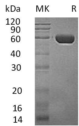 Human CPVL/VCP-Like Recombinant Protein (RPES2667)
