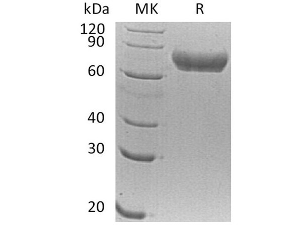 Human FLRT1 Recombinant Protein (RPES2674)