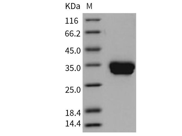 Mouse Carbonic Anhydrase 4 Recombinant Protein (RPES2682)