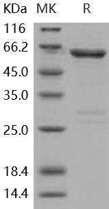 Human ACK1/TNK2 Recombinant Protein (GST Tag) (RPES2697)