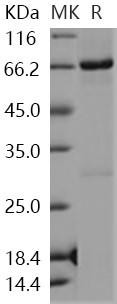 Human NLK Recombinant Protein (His & GST Tag) (Active) (RPES2704)