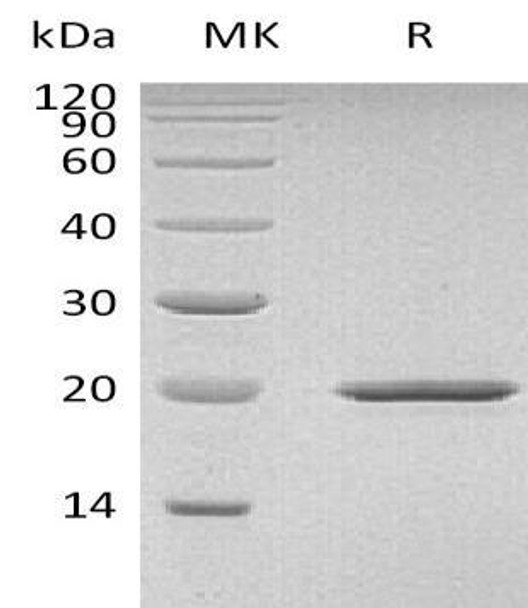Mouse Sonic Hedgehog/SHH Recombinant Protein (RPES2723)