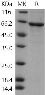 Human CDKL2 Recombinant Protein (RPES2784)