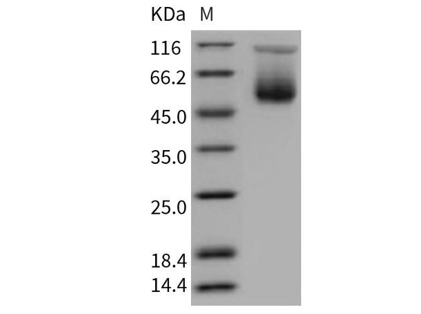 Mouse SerpinA3c Recombinant Protein (His Tag) (RPES2872)