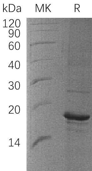 Human ZBP1 Recombinant Protein (RPES2892)