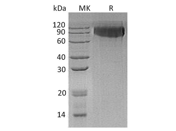 Human GPNMB Recombinant Protein (RPES2918)