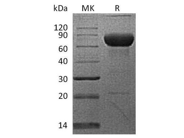 Cynomolgus PD-L2/B7-DC/CD273 Recombinant Protein (RPES2939)