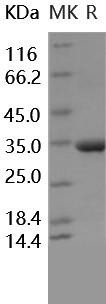 Human MMP-3 Recombinant Protein (Active) (RPES2942)