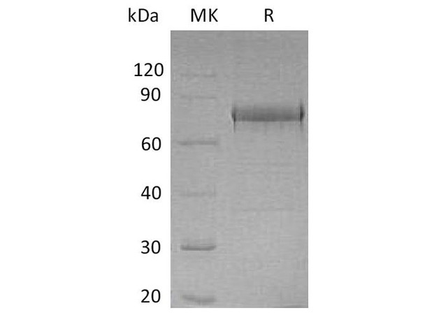 Human EphA1 Recombinant Protein (RPES2956)