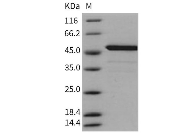 Mouse BID Recombinant Protein (His & GST Tag) (Active) (RPES2970)
