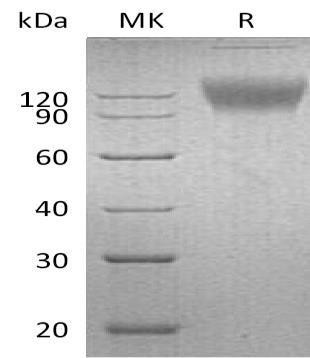 Mouse SIRPA/CD172a Recombinant Protein (RPES2971)