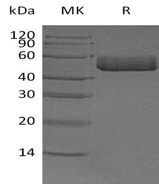 ACPP Recombinant Protein (RPES2988)