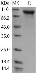 Human Semaphorin 6A/SEMA6A Recombinant Protein (His Tag) (RPES3036)