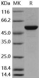 Human MERTK/MER Recombinant Protein (His&GST Tag) (RPES3061)