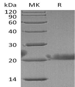Human Lacritin/LACRT Recombinant Protein (RPES3065)
