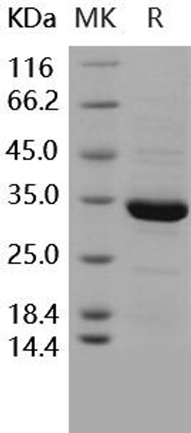 Human ANXA5/Annexin V/Annexin A5 Recombinant Protein (RPES3078)
