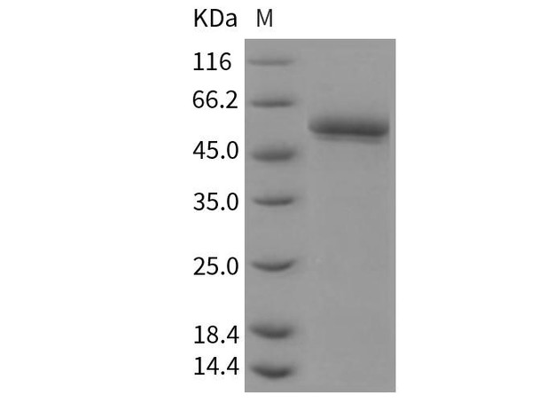Mouse BACE2/Beta secretase 2 Recombinant Protein (RPES3080)