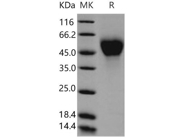 Mouse IL2Ra/CD25 Recombinant Protein (His Tag) (RPES3081)