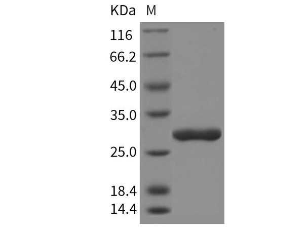 Rat Chymotrypsinogen B/CTRB1 Recombinant Protein (His Tag) (RPES3098)