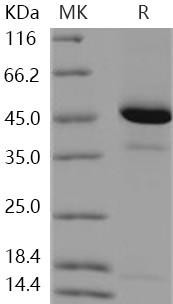 Human REG4/RELP Recombinant Protein (Fc Tag) (RPES3117)
