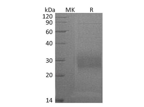 Mouse CD74 Recombinant Protein (RPES3133)