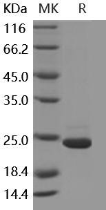 Human GKN1/Gastrokine 1 Recombinant Protein (His Tag) (RPES3136)