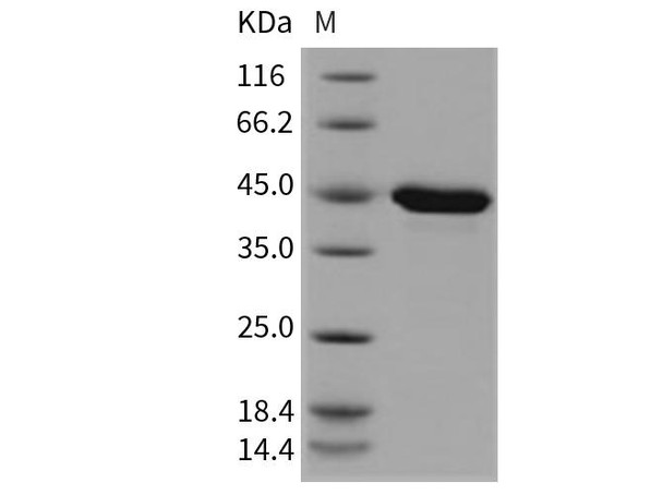 Mouse PPM1A Recombinant Protein (His Tag) (RPES3197)