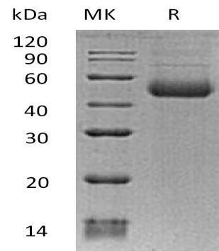 Human ST8SIA1 Recombinant Protein (RPES3245)