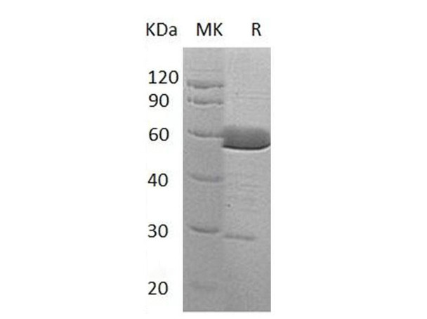 Human Alpha-Parvin/PARVA Recombinant Protein (RPES3266)